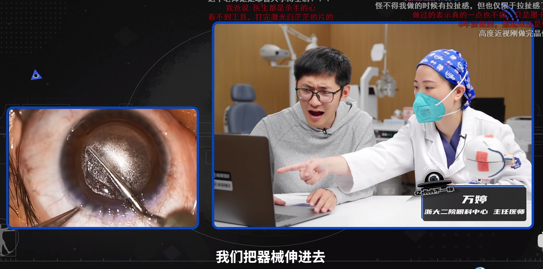 近视眼全飞秒手术（前方高能）1