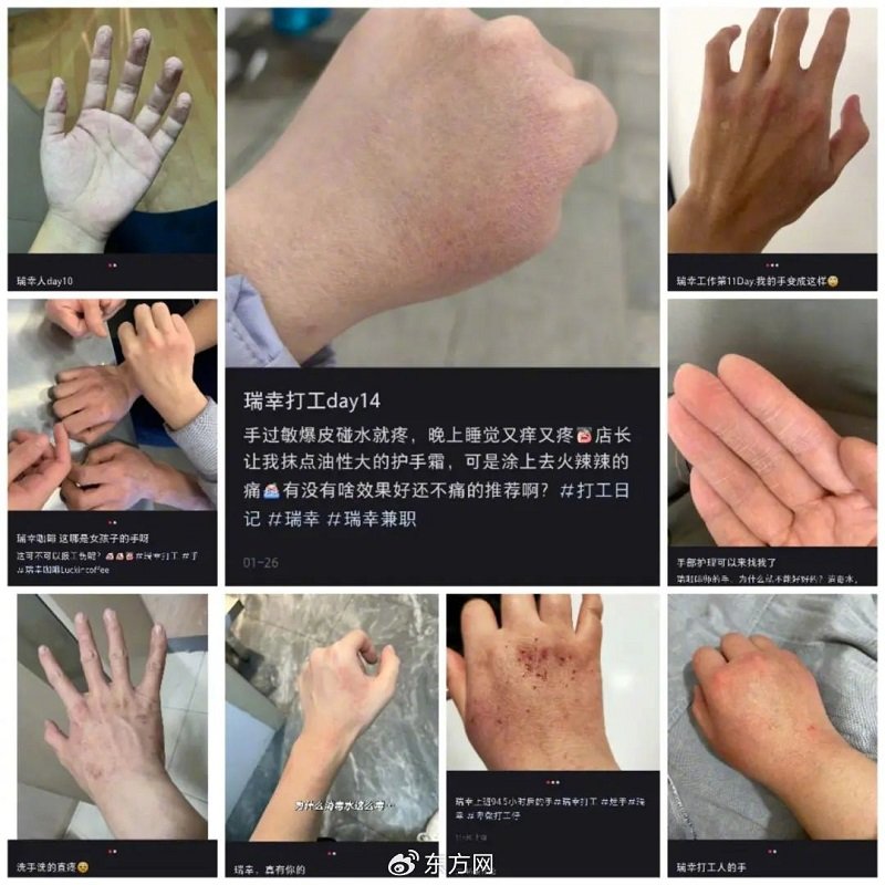 咖啡师烂手算工伤吗？2