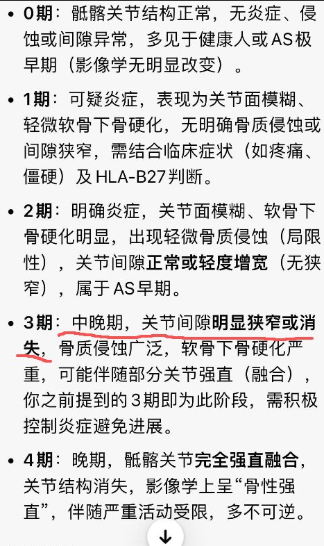 确诊强直性脊柱炎了，中晚期1